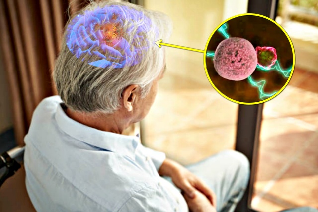 활성산소 심장마비 알츠하이머 치매, 항산화성분, 건강 팁줌 매일꿀정보