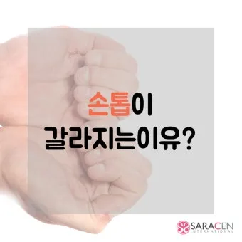 손톱이 갈라지는 이유 원인 증상 대처법_16