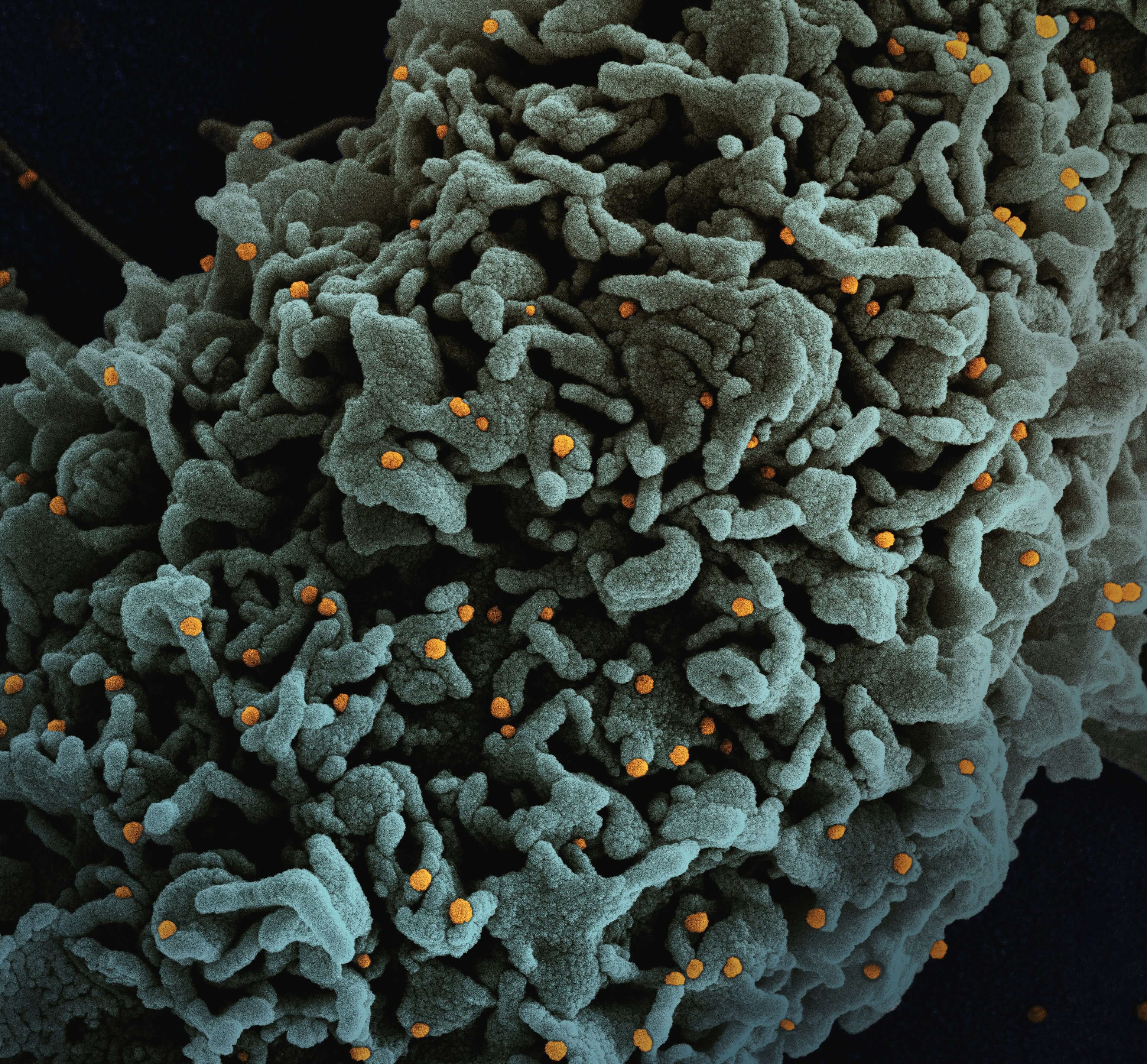 코로나19 재유행 우려