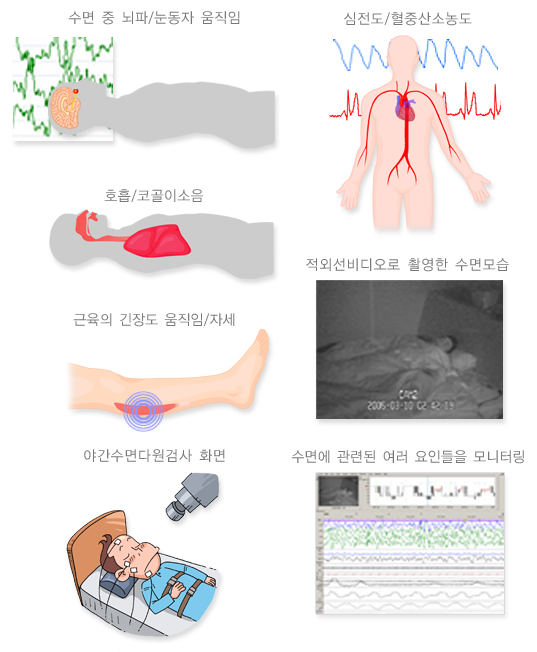 수면다원검사