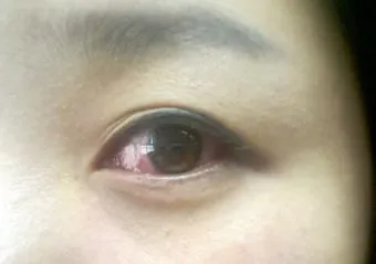고양이 털 알레르기 완화 방법과 생활 관리 팁_20