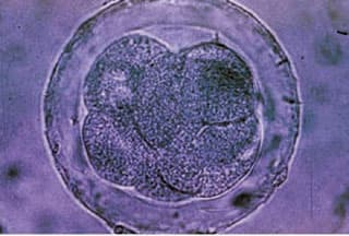 줄기 세포의 종류와 재생 의학에서의 역할