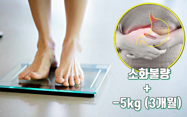 위암 초기 증상 체중감소, 건강 팁줌 매일꿀정보