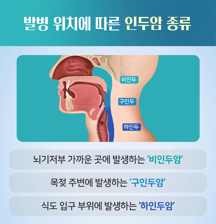 비인두암 생존율 증상 검사 원인 예방법 건강정보 암예방 EpsteinBarr 비인두암치료