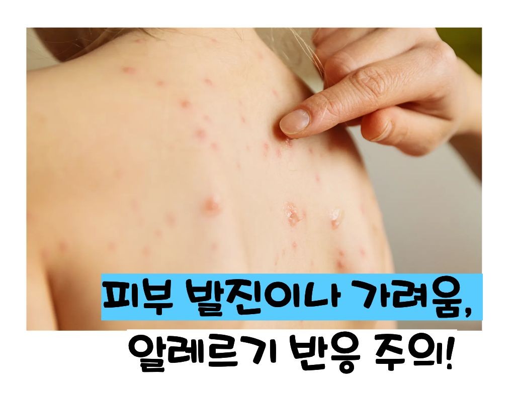 고지혈증 약의 부작용