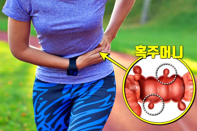 왼쪽 옆구리 통증 의심되는병 혹주머니 게실염 증상, 건강 팁줌 매일꿀정보