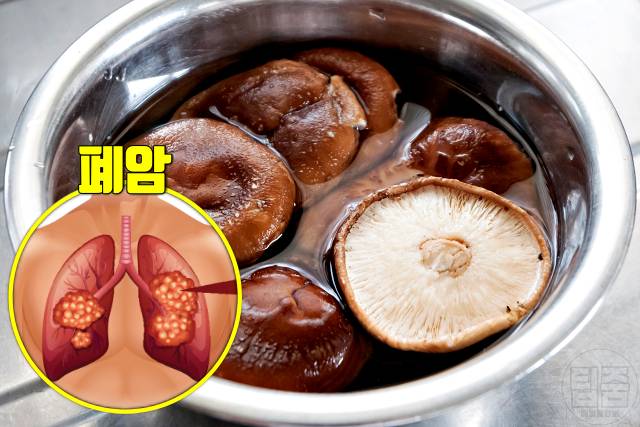 암과 싸우는 음식 암예방 음식 표고버섯 효능