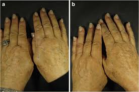 작은 믿음 고린도후서 4장 16절