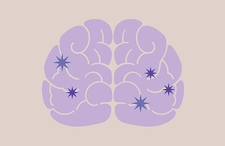 뇌-내-신경전달물질-불균형