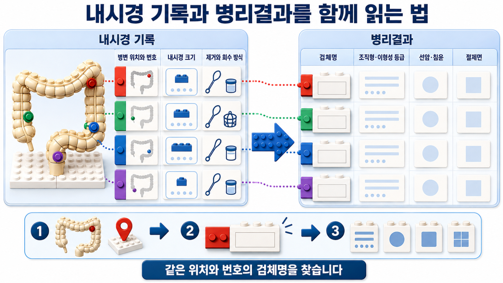 대장내시경 기록의 병변 위치·번호·크기·제거 방식과 병리결과 검체명을 색상 태그로 연결하는 방법