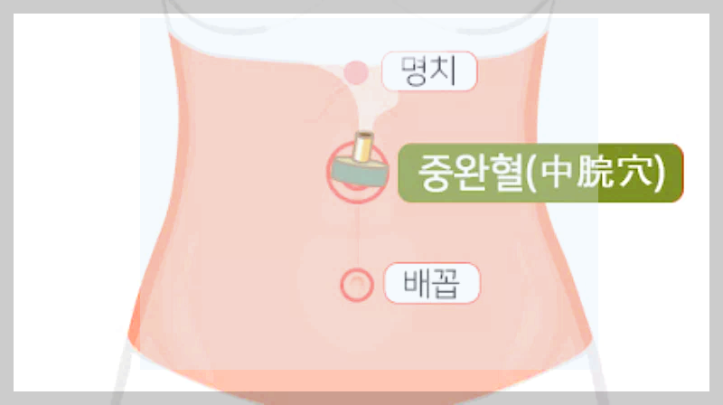 중완혈