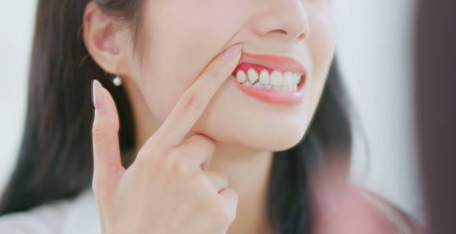 치주염이 발생한 당뇨병 허ㅏㄴ자