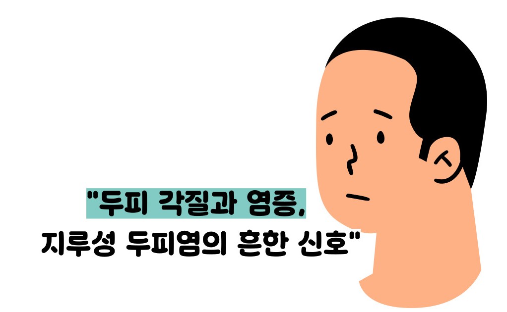 지루성 두피염