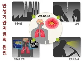 폐질환의 종류 7가지와 예방법 건강관리 필수_22