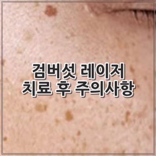 검버섯 레이저 치료 후 주의사항