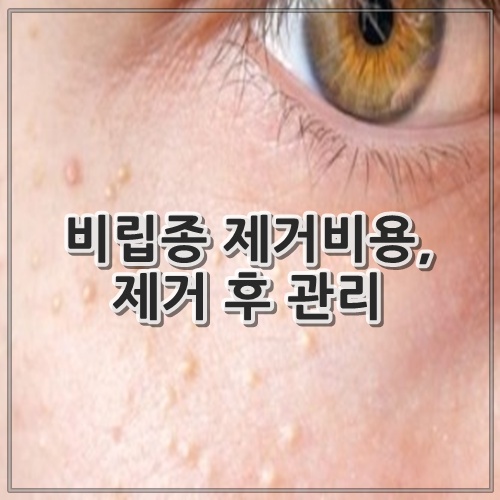 비립종 제거비용, 제거 후 관리