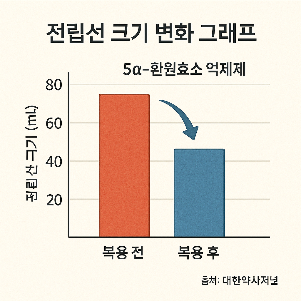 전립선 그래프