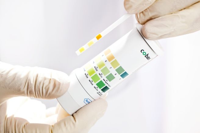 오줌 색깔과 병