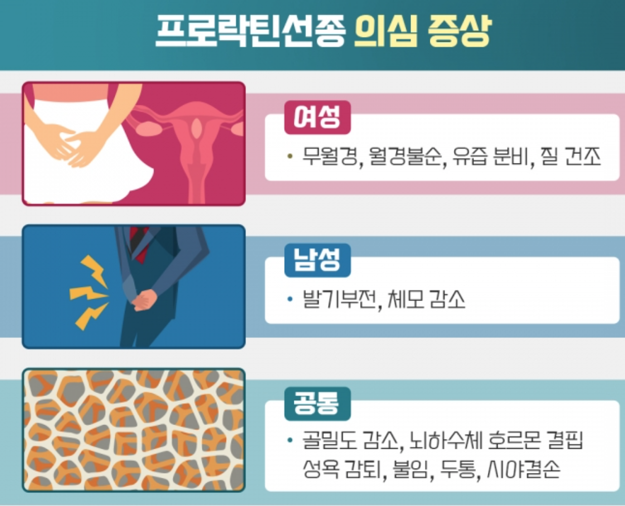 대표적인 프로락틴 선종 의심 증상