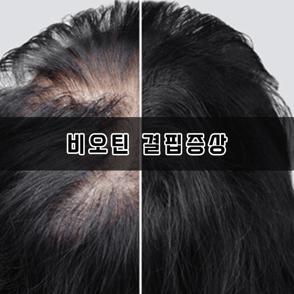 비오틴 결핍증상