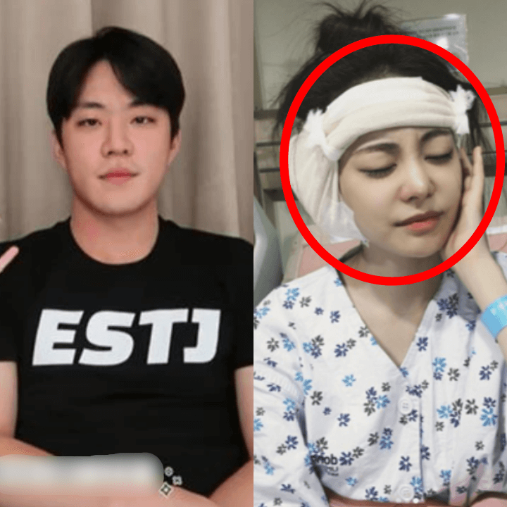 서주원-아옳이-수술사진-인스타