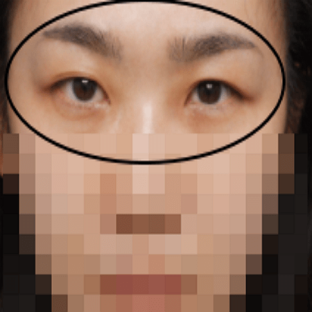 이마거상술 전 여성의 사진
