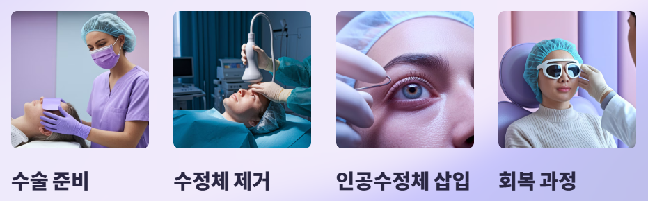 백내장 치료 순서