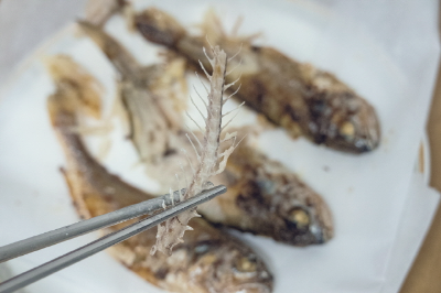 목에 가시가 걸렸을때 이렇게 해보세요~