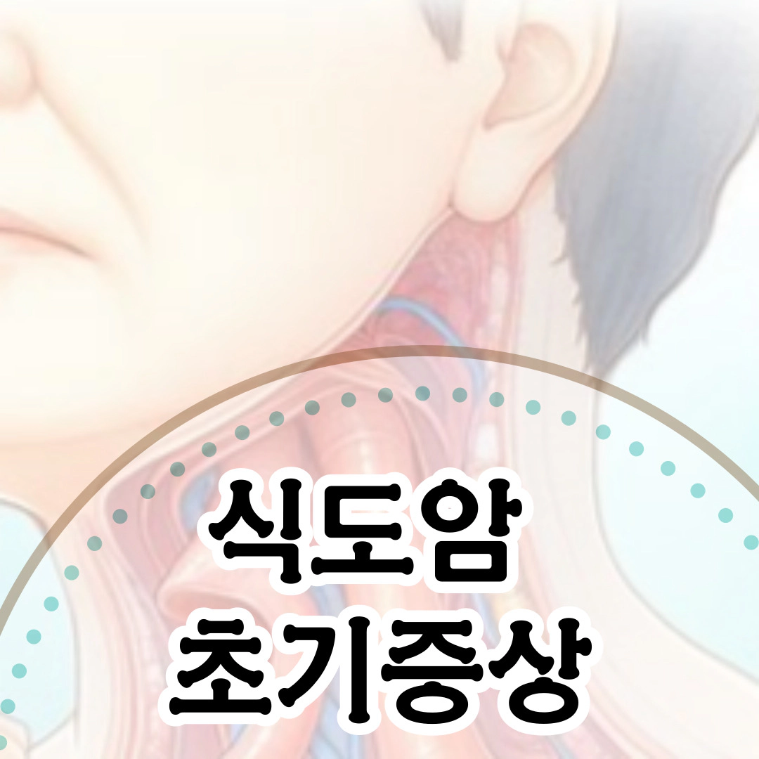 [식도암] 초기 증상-증상