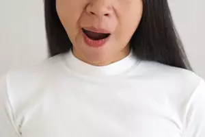 뇌졸중 전조증상