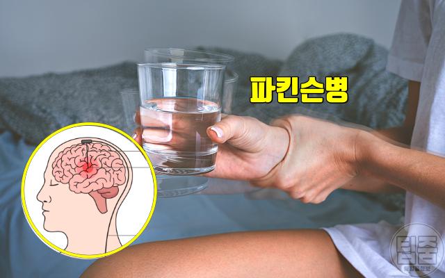 치매 파킨슨병 초기증상