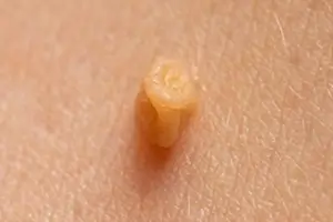 쥐젖