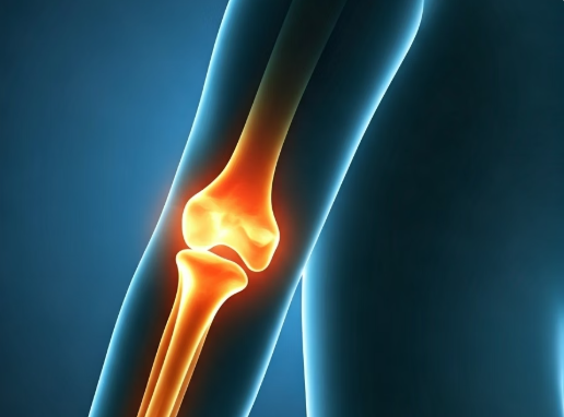 난각막이란 무엇이며, 왜 관절에 좋을까요?