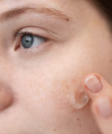 몸이 가려운 이유 17