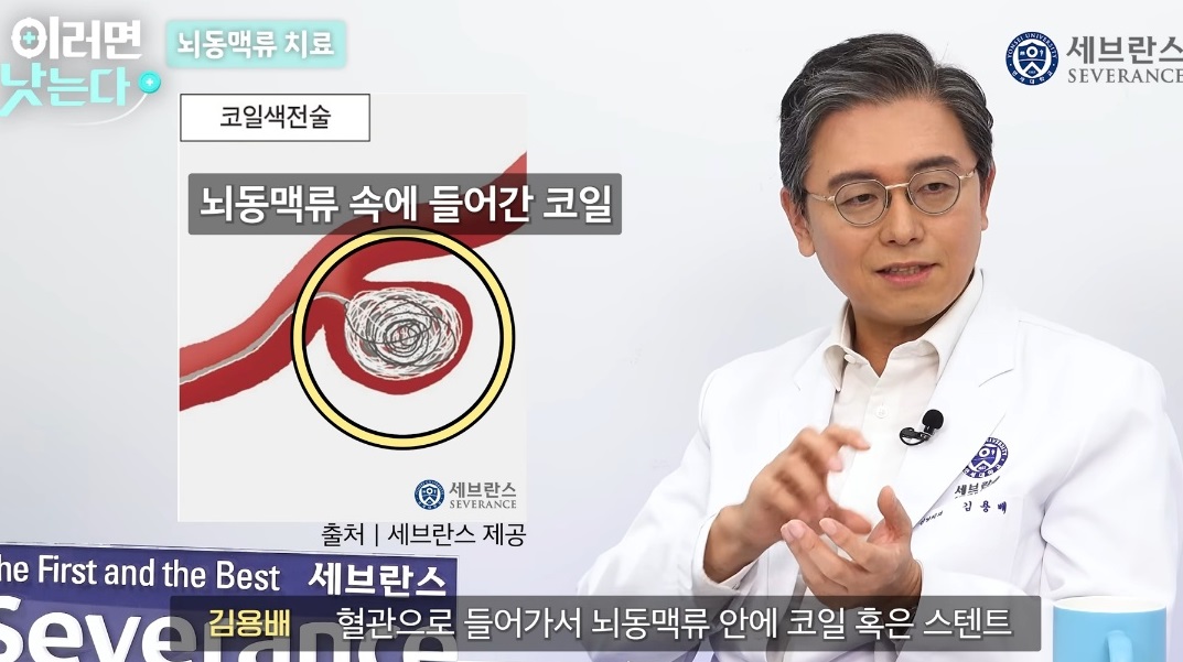 뇌동맥류-김용배-교수