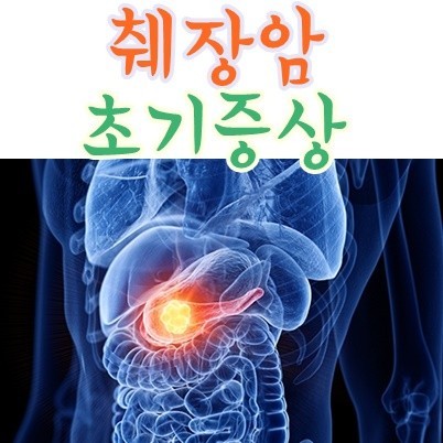 췌장암 초기 증상