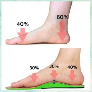 족저근막염 깔창 고르는 법