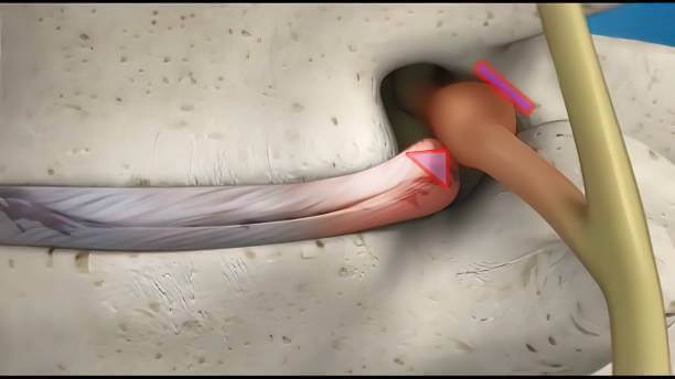 뒷목 땡김 이 있는 두통 여러가지 원인들이 있습니다. 두통이 있을 때 목 뒤가 따끔거리는 느낌이 들고 어깨 승모근이 뭉쳐져있습니다. 근육이완제와 진통제를 자주 복용하고 어깨를 마사지해도 뒷머리가 쪼개지거나 머리 전체가 터질 것 같은 두통이 계속된다면 매우 힘듭니다. 원인이 무엇인지 참고하시기 바랍니다.