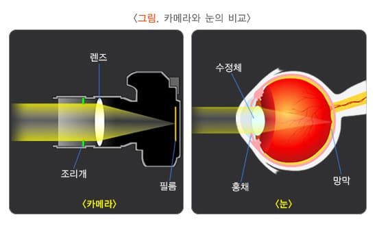 백내장, 진단부터 수술, 비용까지 완벽 가이드