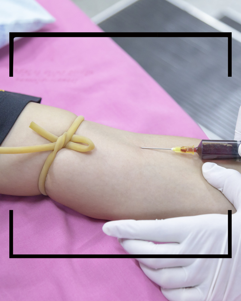 콜레스테롤 정상수치