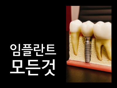임플란트가격