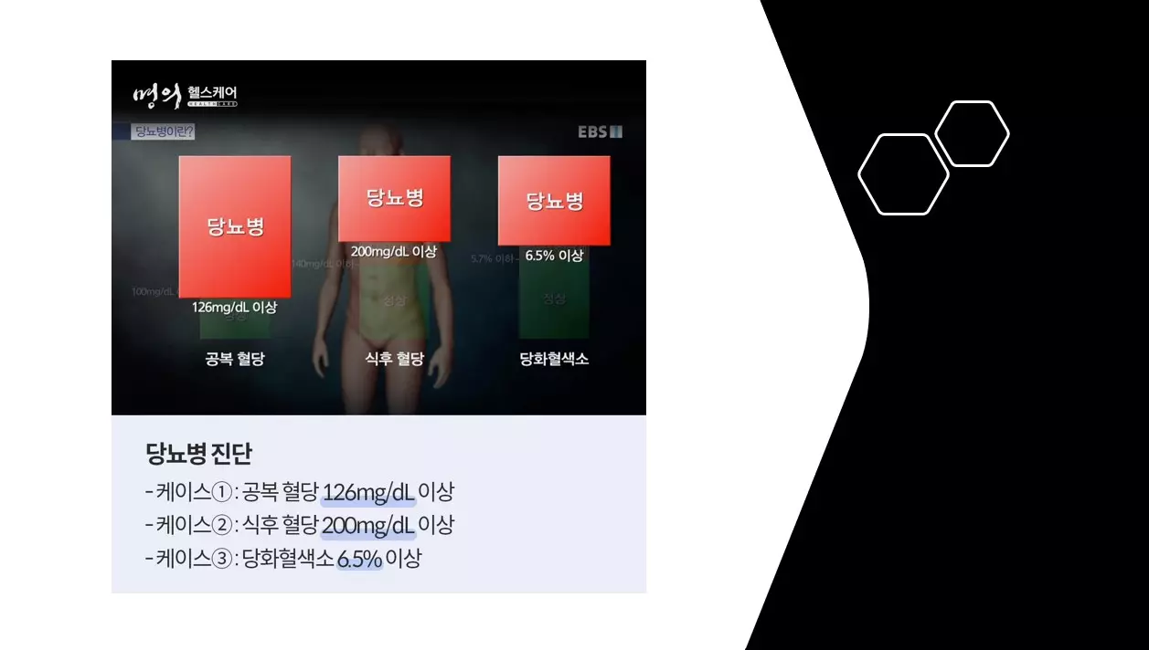 당뇨병 진단기준