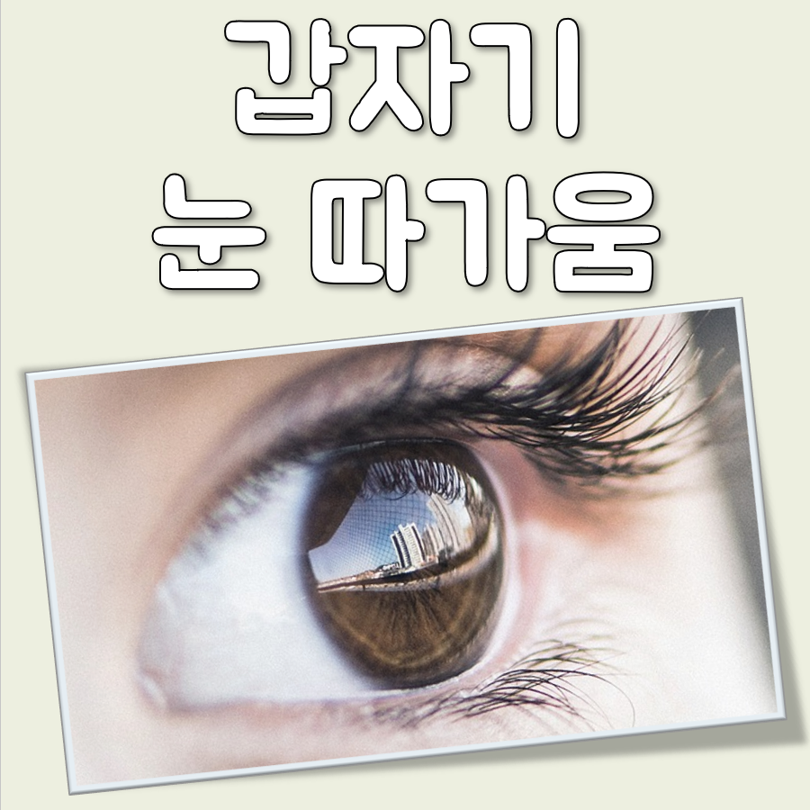갑자기 눈 따가움 대표 이미지
