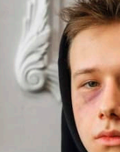 멍이 잘 드는 이유와 오래가는 이유&amp;#44; 병일까?