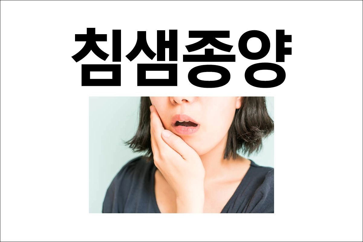침샘종양 원인 증상 진단 치료 예방