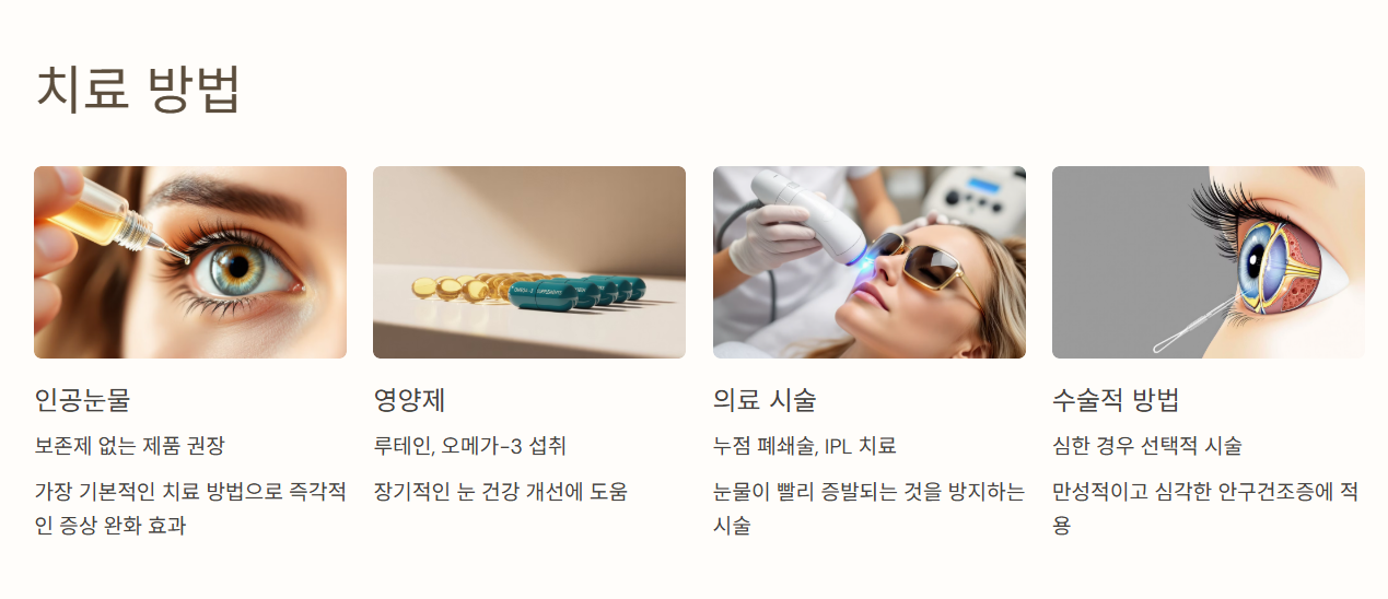 안구건조증 치료, 어떤 게 있을까요?