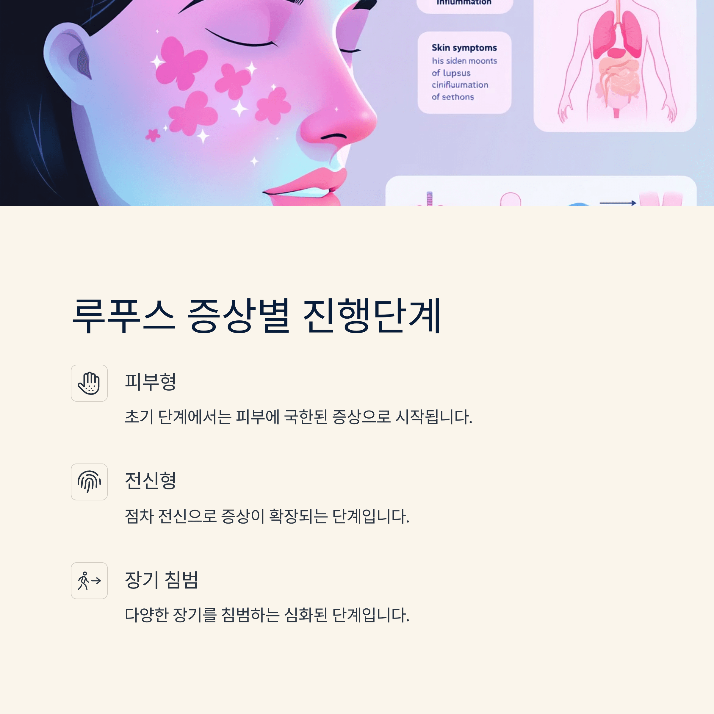 루푸스 증상별 진행단계