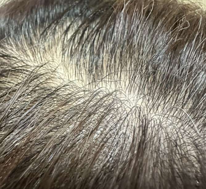 하아르 닥터모리엔 탈모 효과