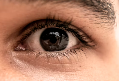 눈꺼풀 처짐의 치료방법