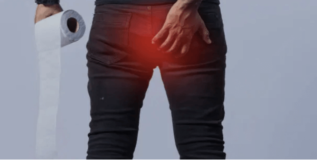 치질의 증상과 치질 자가치료법, 치질 예방법 요약정리